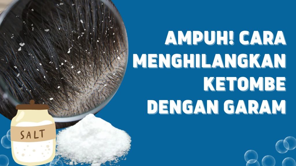 Cara Menghilangkan Ketombe Dengan Garam