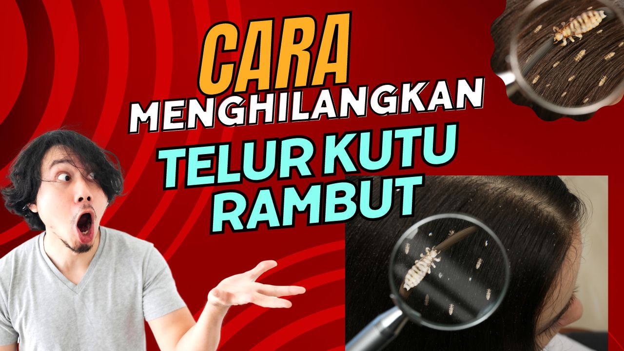 Cara Menghilangkan Telur Kutu Rambut Nurul Hidayah 